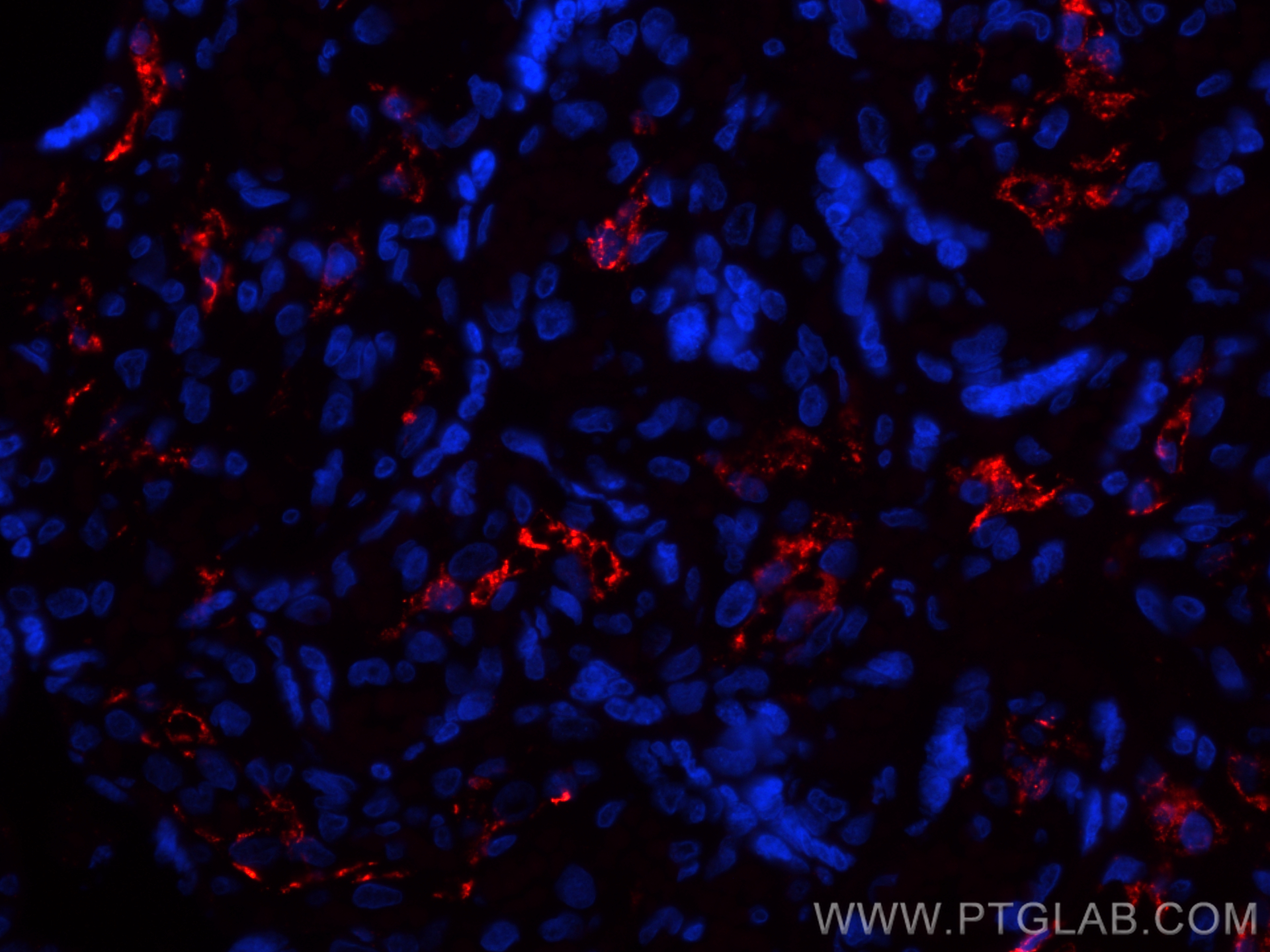 Immunofluorescence (IF) / fluorescent staining of human placenta tissue using CoraLite®594-conjugated CD206 Recombinant antibody (CL594-81525)