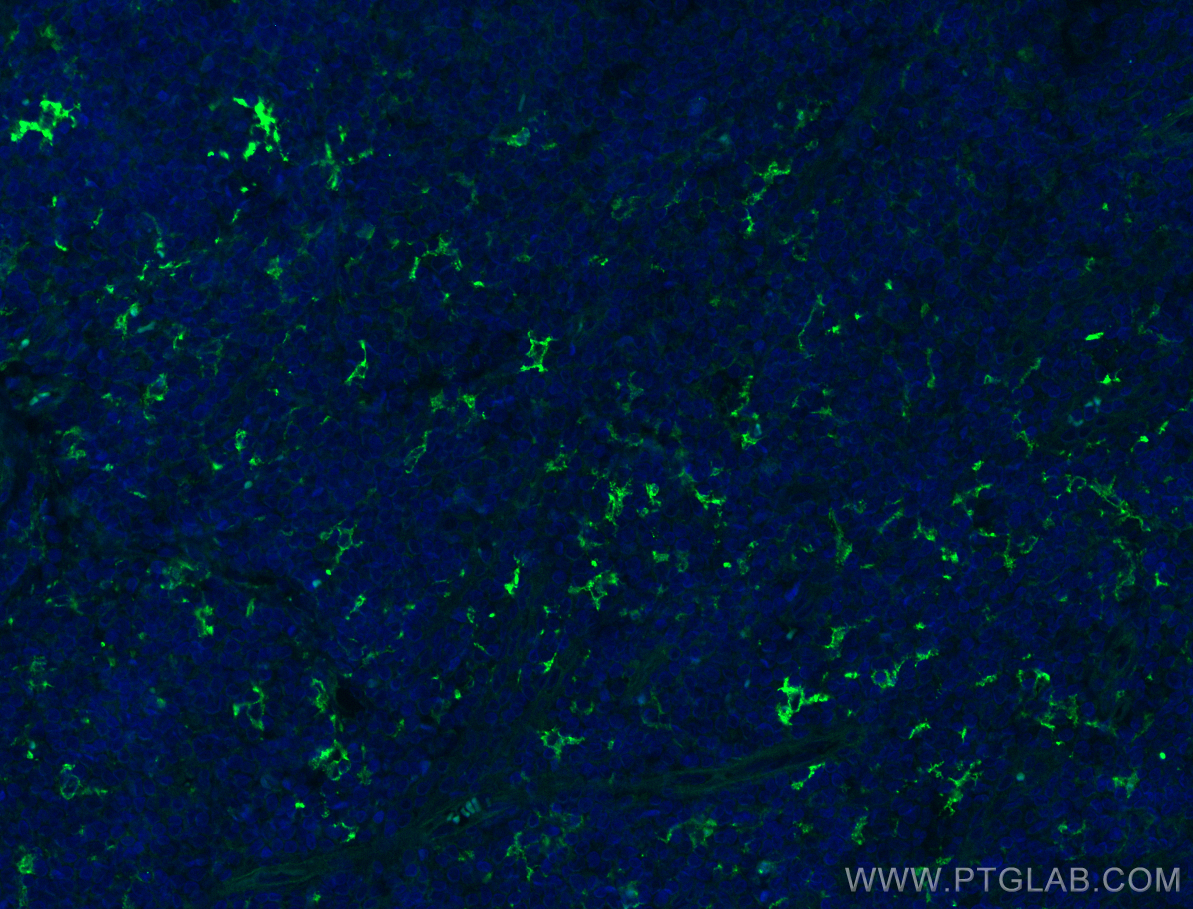 Immunofluorescence (IF) / fluorescent staining of human tonsillitis tissue using CD209 Polyclonal antibody (25404-1-AP)