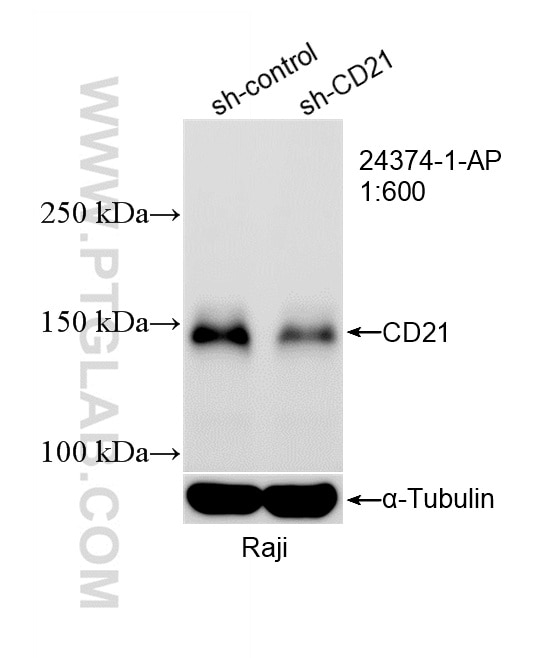 Western Blot (WB) analysis of Raji cells using CD21 Polyclonal antibody (24374-1-AP)