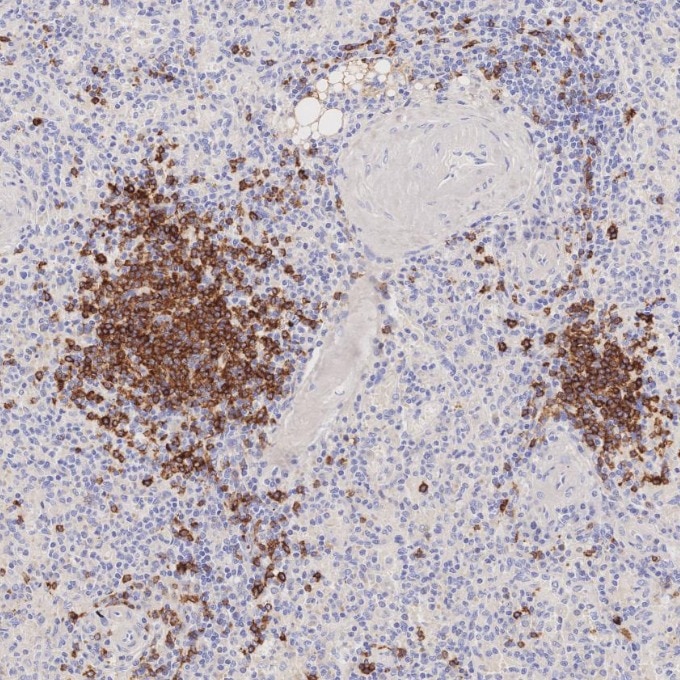 Immunohistochemistry (IHC) staining of human spleen tissue using CD22 Monoclonal antibody (66103-1-Ig)