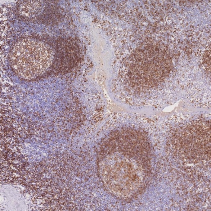 Immunohistochemistry (IHC) staining of human tonsillitis tissue using CD22 Monoclonal antibody (66103-1-Ig)