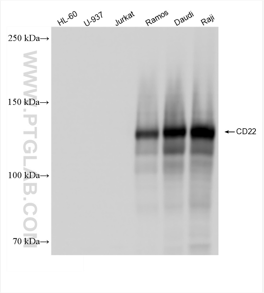 Western Blot (WB) analysis of various lysates using CD22 Recombinant antibody (83303-1-RR)