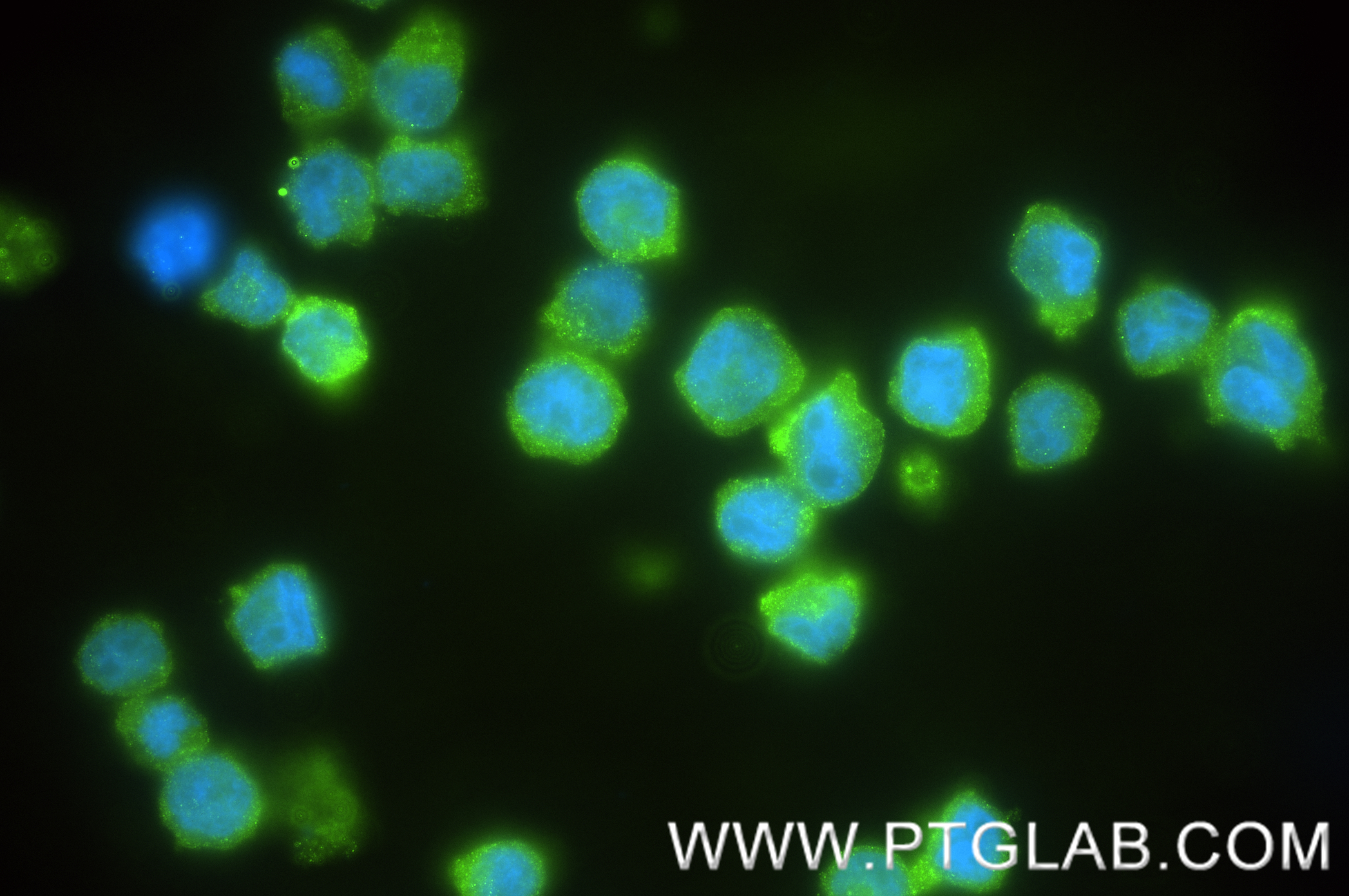 Immunofluorescence (IF) / fluorescent staining of HEL cells using CD226 Recombinant antibody (82991-3-RR)