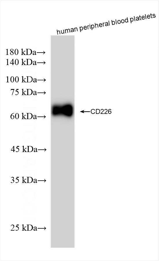 Western Blot (WB) analysis of human peripheral blood platelets using CD226 Recombinant antibody (82991-4-RR)