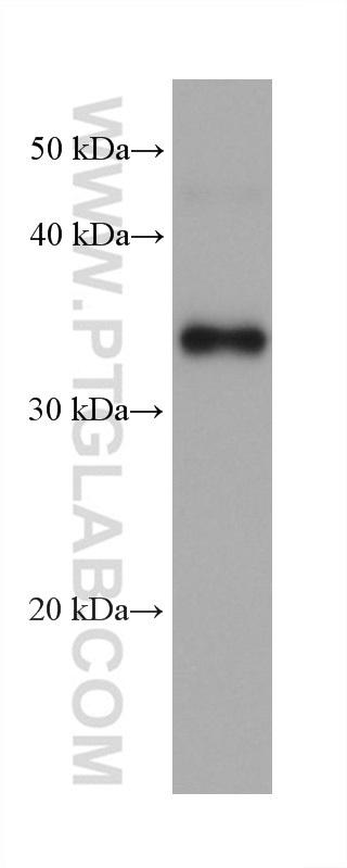 Western Blot (WB) analysis of DC2.4 cells using CD23 Monoclonal antibody (60208-1-Ig)