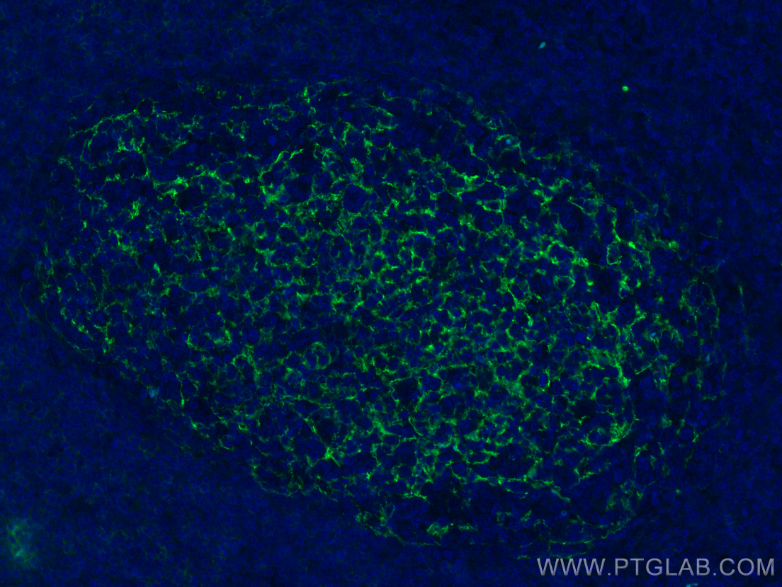 Immunofluorescence (IF) / fluorescent staining of human tonsillitis tissue using CD23 Monoclonal antibody (60208-2-Ig)