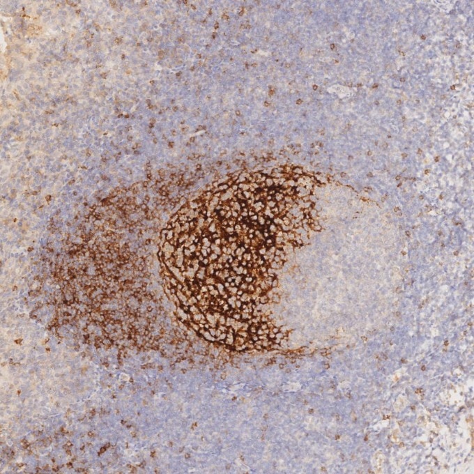 Immunohistochemistry (IHC) staining of human tonsillitis tissue using CD23 Monoclonal antibody (60208-2-Ig)