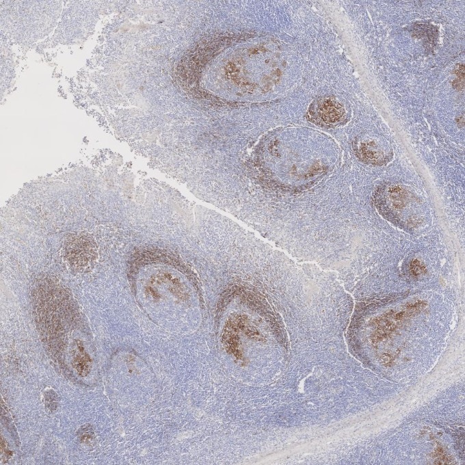 Immunohistochemistry (IHC) staining of human tonsillitis tissue using CD23 Monoclonal antibody (60208-2-Ig)