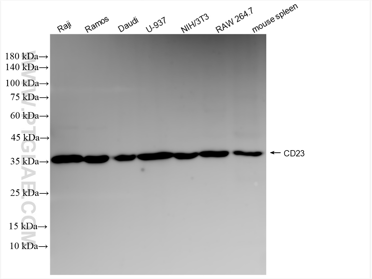 Western Blot (WB) analysis of various lysates using CD23 Recombinant antibody (84024-2-RR)