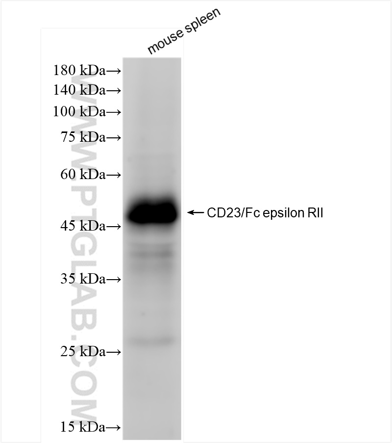 Western Blot (WB) analysis of mouse spleen tissue using CD23/Fc epsilon RII Recombinant antibody (84212-3-RR)