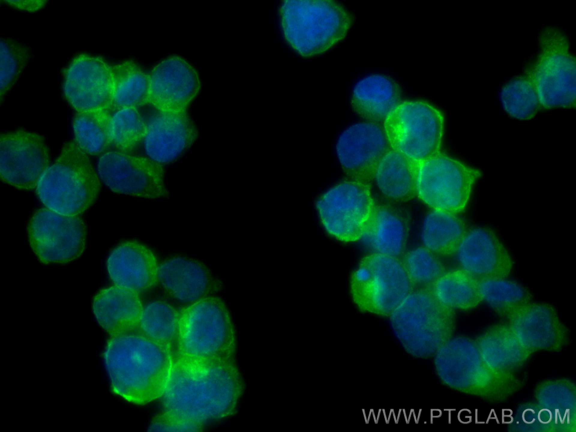 Immunofluorescence (IF) / fluorescent staining of Jurkat cells using CoraLite® Plus 488-conjugated CD247 Polyclonal ant (CL488-12837)