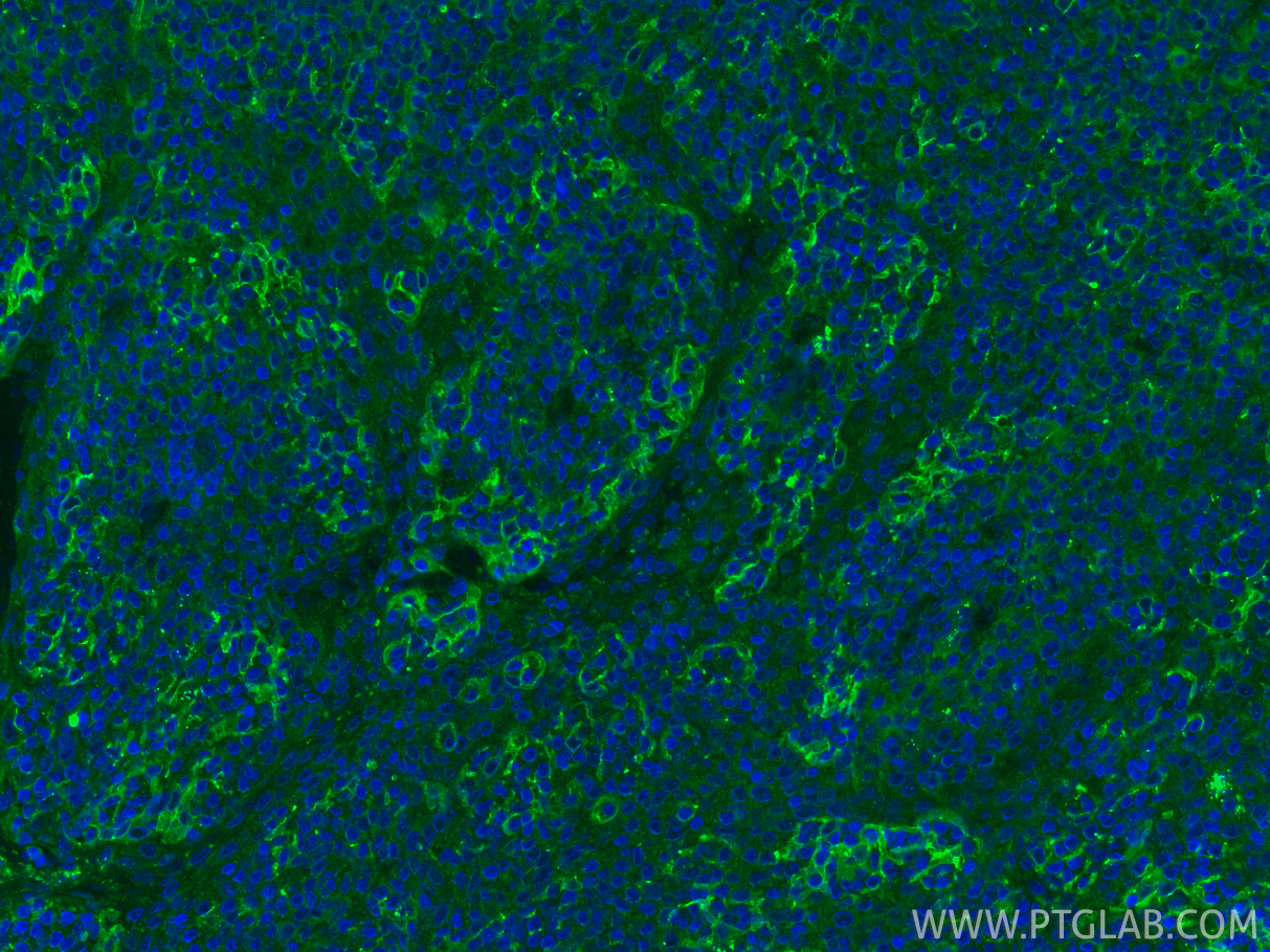 Immunofluorescence (IF) / fluorescent staining of human tonsillitis tissue using PD-L1/CD274 Polyclonal antibody (17952-1-AP)