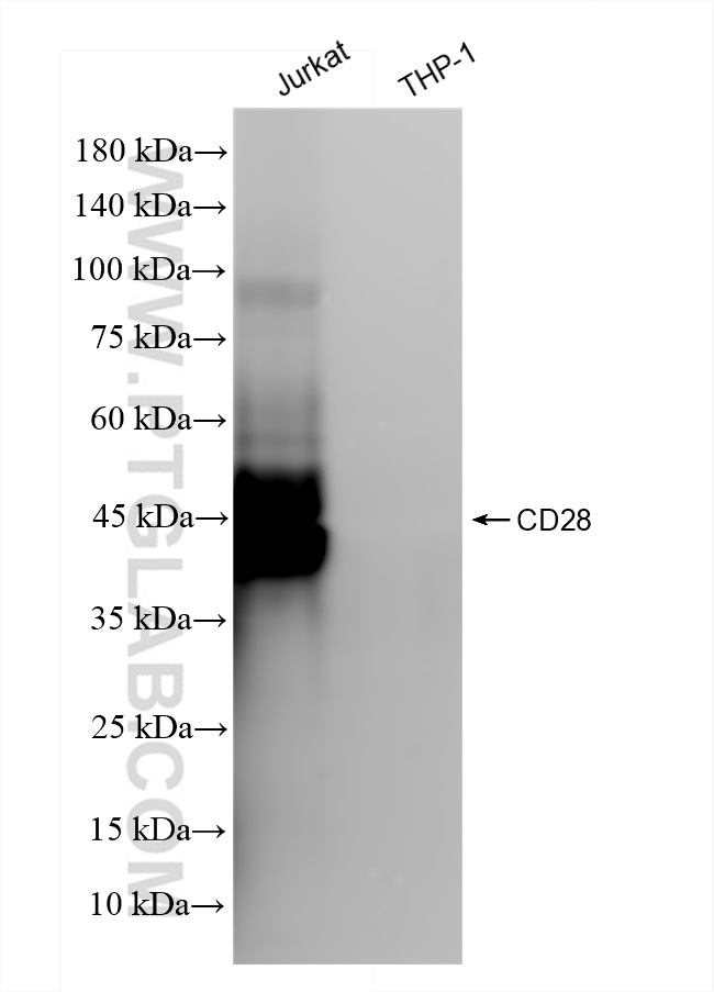 Western Blot (WB) analysis of various lysates using CD28 Recombinant antibody (83383-7-RR)