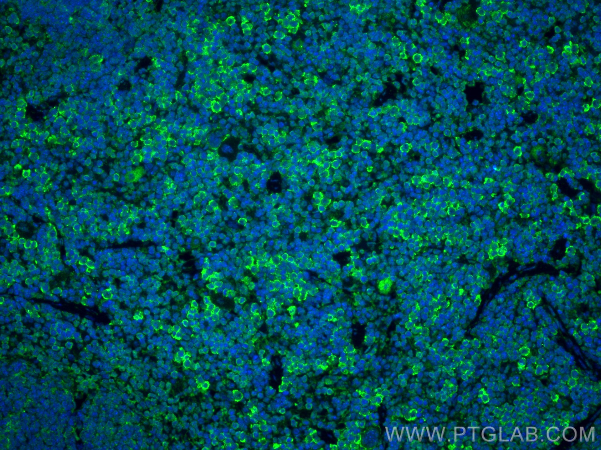 Immunofluorescence (IF) / fluorescent staining of mouse spleen tissue using CD3 Recombinant antibody (81324-1-RR)