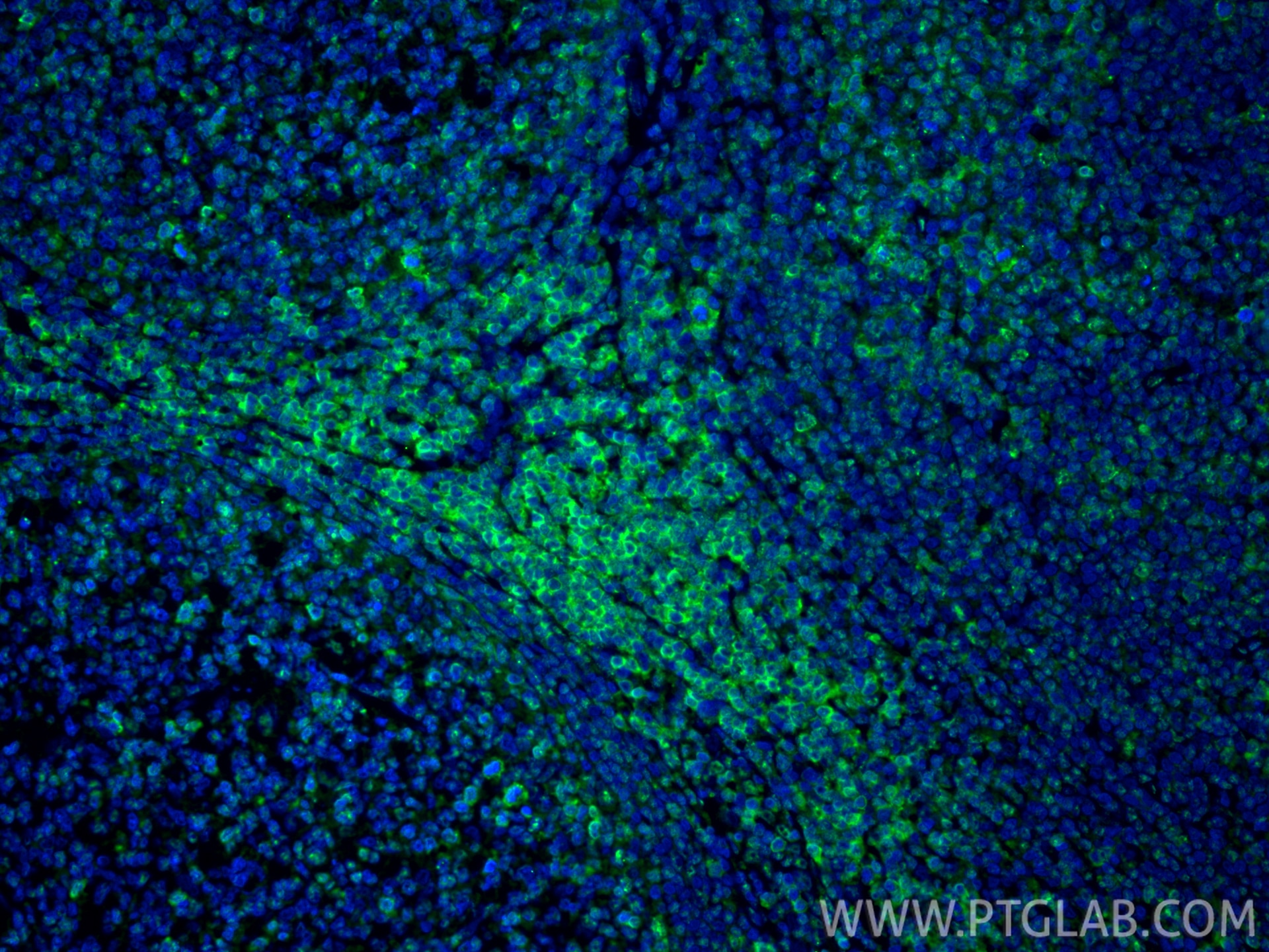 Immunofluorescence (IF) / fluorescent staining of human tonsillitis tissue using CD3 Recombinant monoclonal antibody (81324-1-RR)