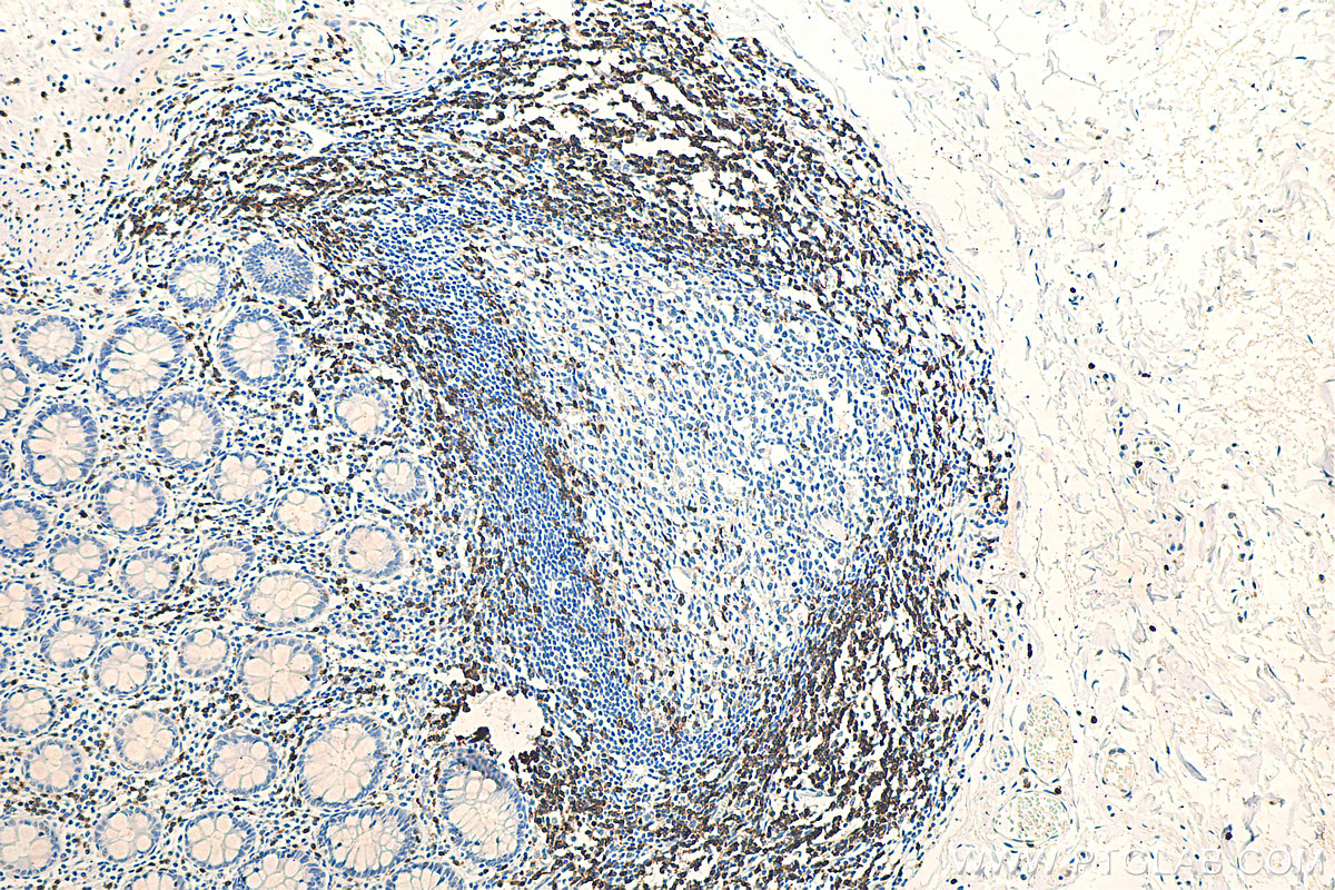 Immunohistochemistry (IHC) staining of human colon tissue using CD3 Recombinant antibody (81324-1-RR)