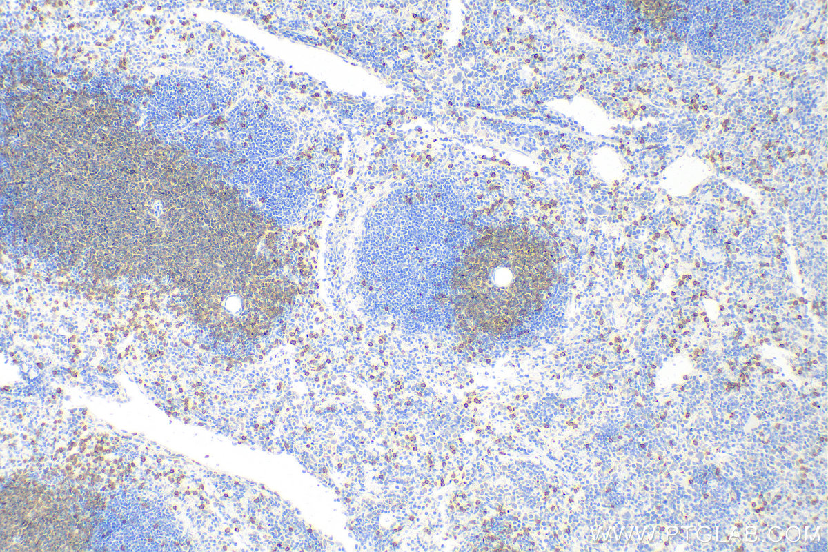 Immunohistochemistry (IHC) staining of mouse spleen tissue using CD3 Recombinant antibody (81324-1-RR)