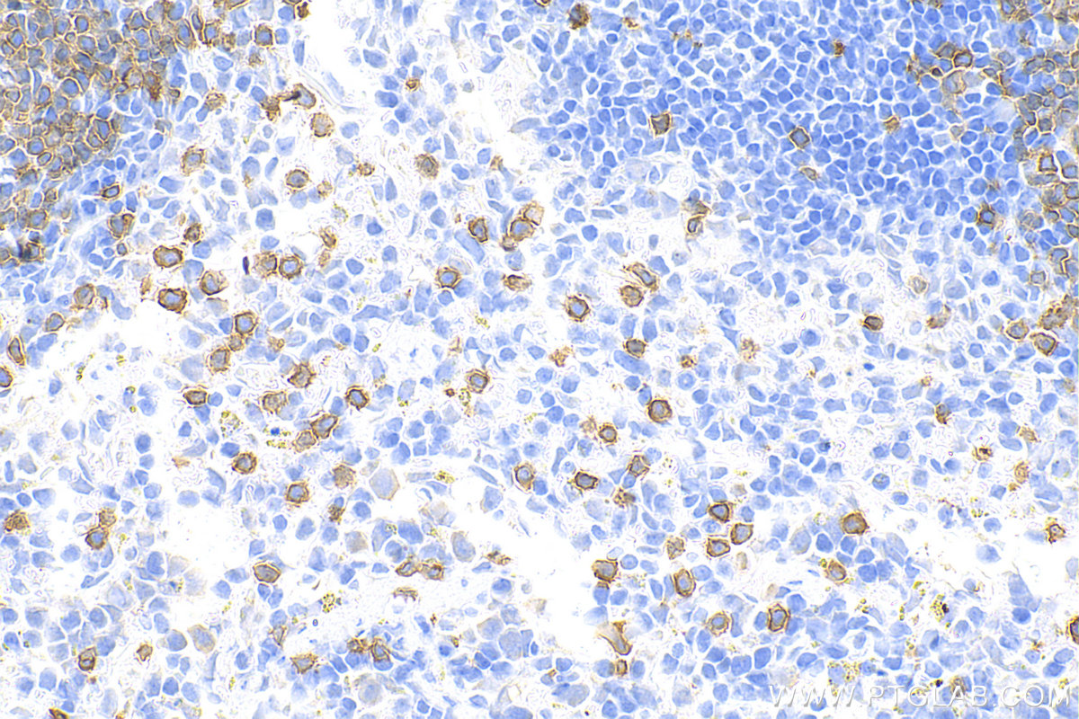 Immunohistochemistry (IHC) staining of mouse spleen tissue using CD3 Recombinant antibody (81324-1-RR)