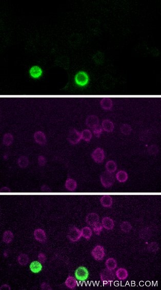 Immunofluorescence (IF) / fluorescent staining of human PBMCs using CoraLite® Plus 555 Anti-Human CD3 (UCHT1) (CL555-65151)