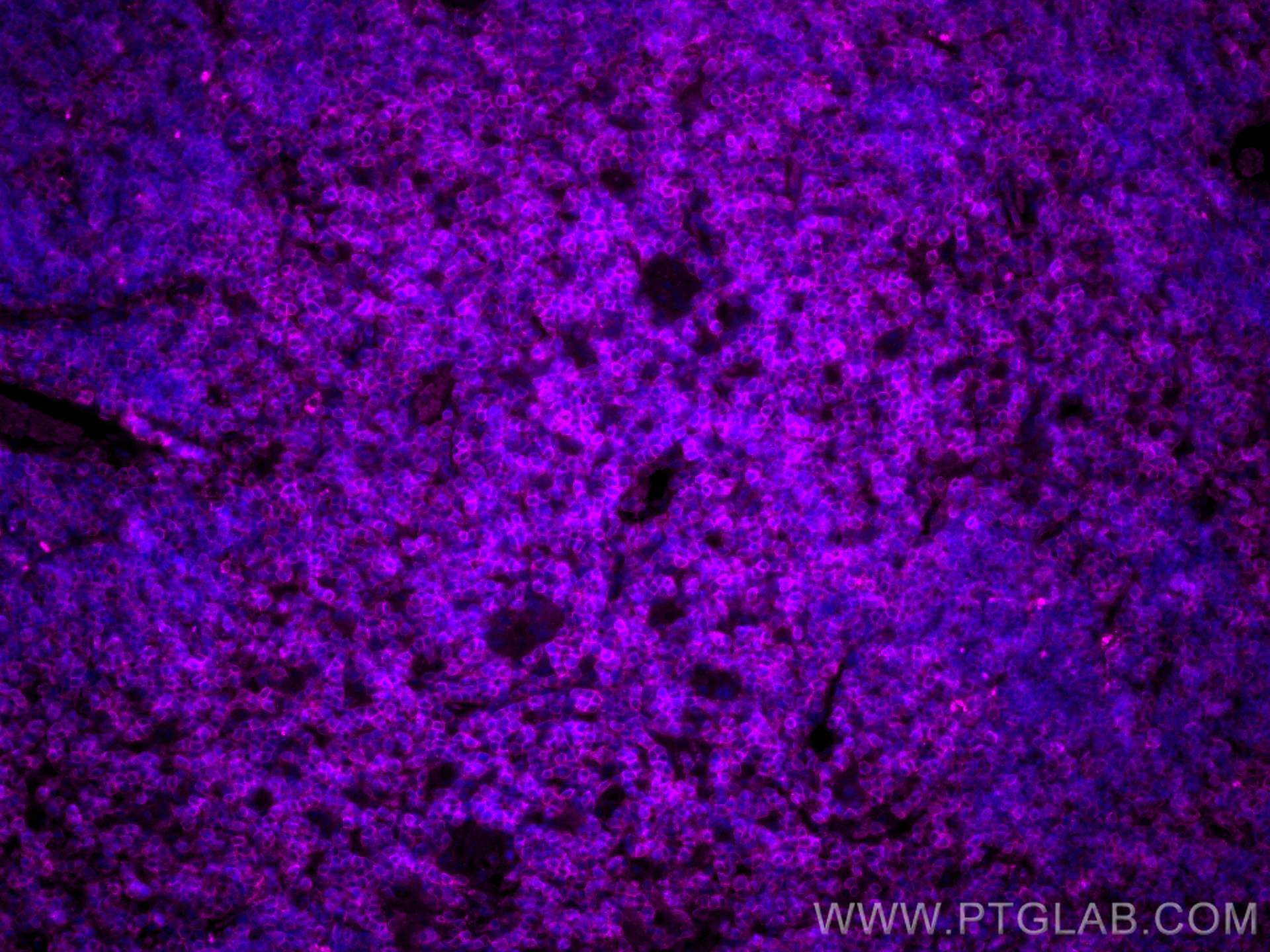 Immunofluorescence (IF) / fluorescent staining of mouse thymus tissue using CoraLite® Plus 647-conjugated CD3 Polyclonal antib (CL647-17617)