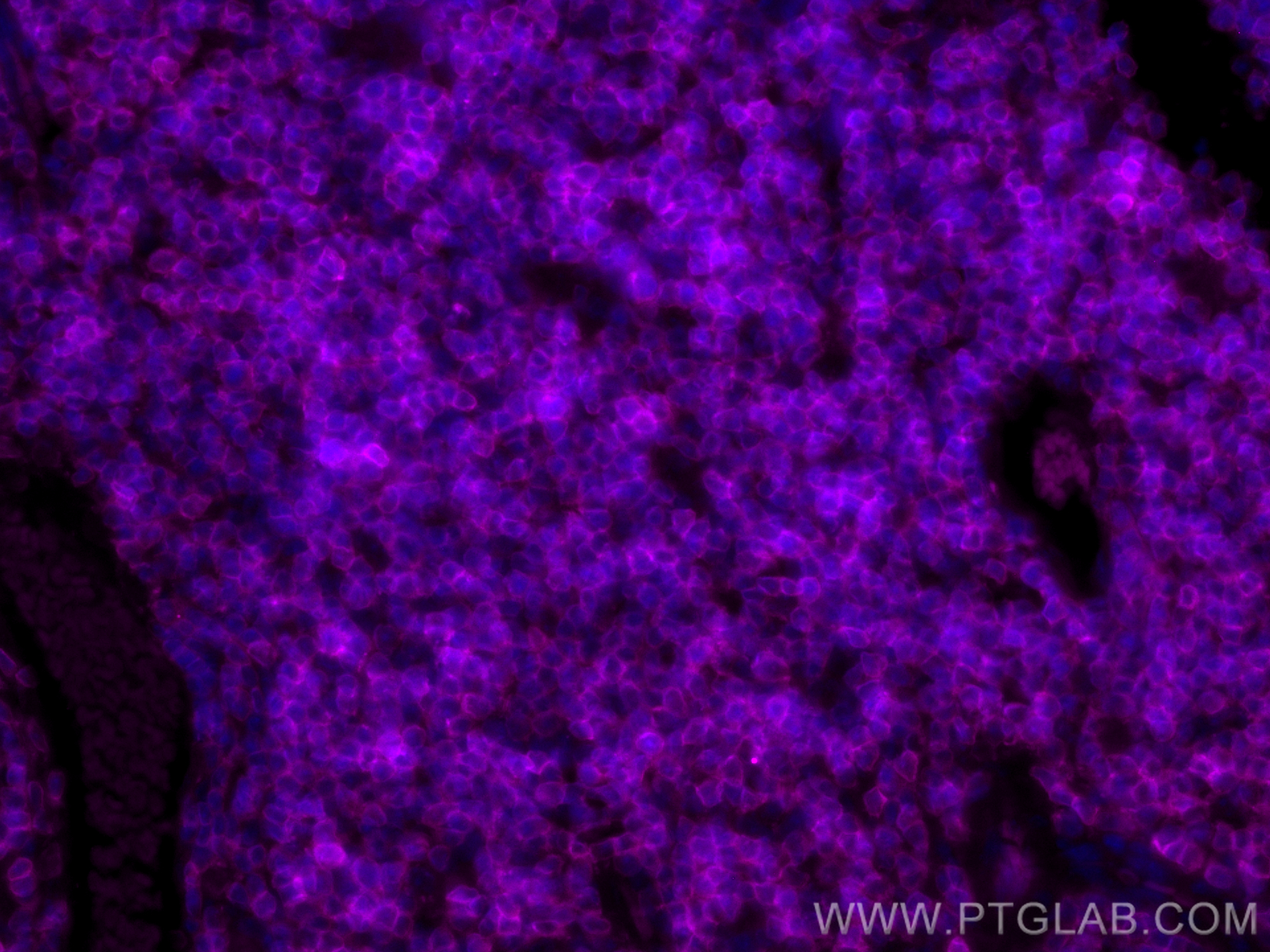 Immunofluorescence (IF) / fluorescent staining of mouse thymus tissue using CoraLite® Plus 647-conjugated CD3 Polyclonal antib (CL647-17617)