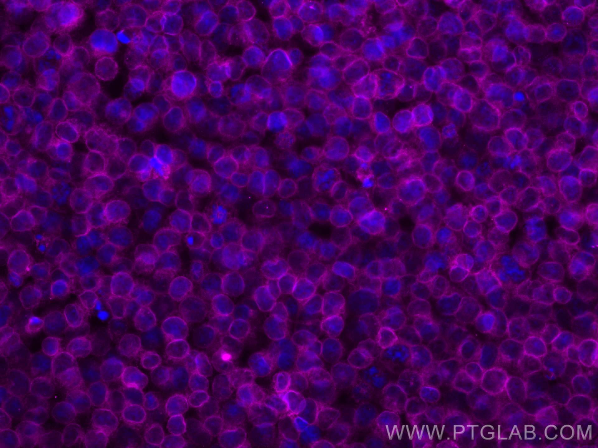 Immunofluorescence (IF) / fluorescent staining of Jurkat cells using CoraLite® Plus 647-conjugated CD3 Monoclonal antib (CL647-60181)