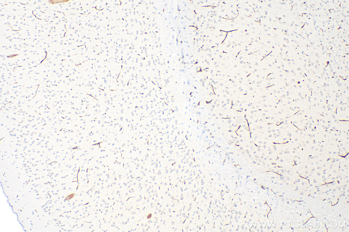 Immunohistochemistry (IHC) staining of mouse brain tissue using CD31 Polyclonal antibody (32387-1-AP)