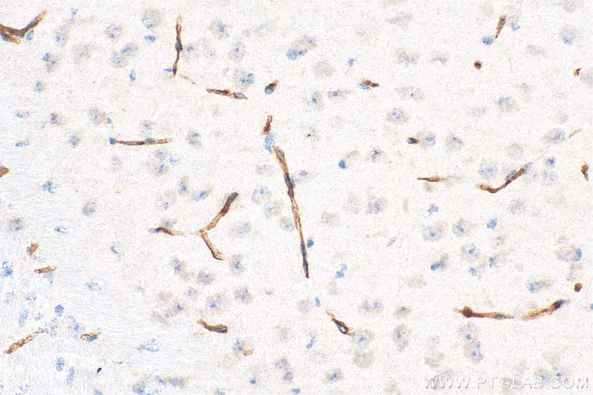 Immunohistochemistry (IHC) staining of mouse brain tissue using CD31 Polyclonal antibody (32387-1-AP)