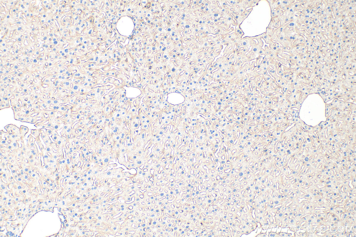 Immunohistochemistry (IHC) staining of mouse liver tissue using CD31 Polyclonal antibody (32387-1-AP)
