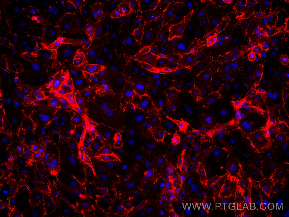 Immunofluorescence (IF) / fluorescent staining of HUVEC cells using Anti-Human CD31 (WM-59) (65268-1-Ig)