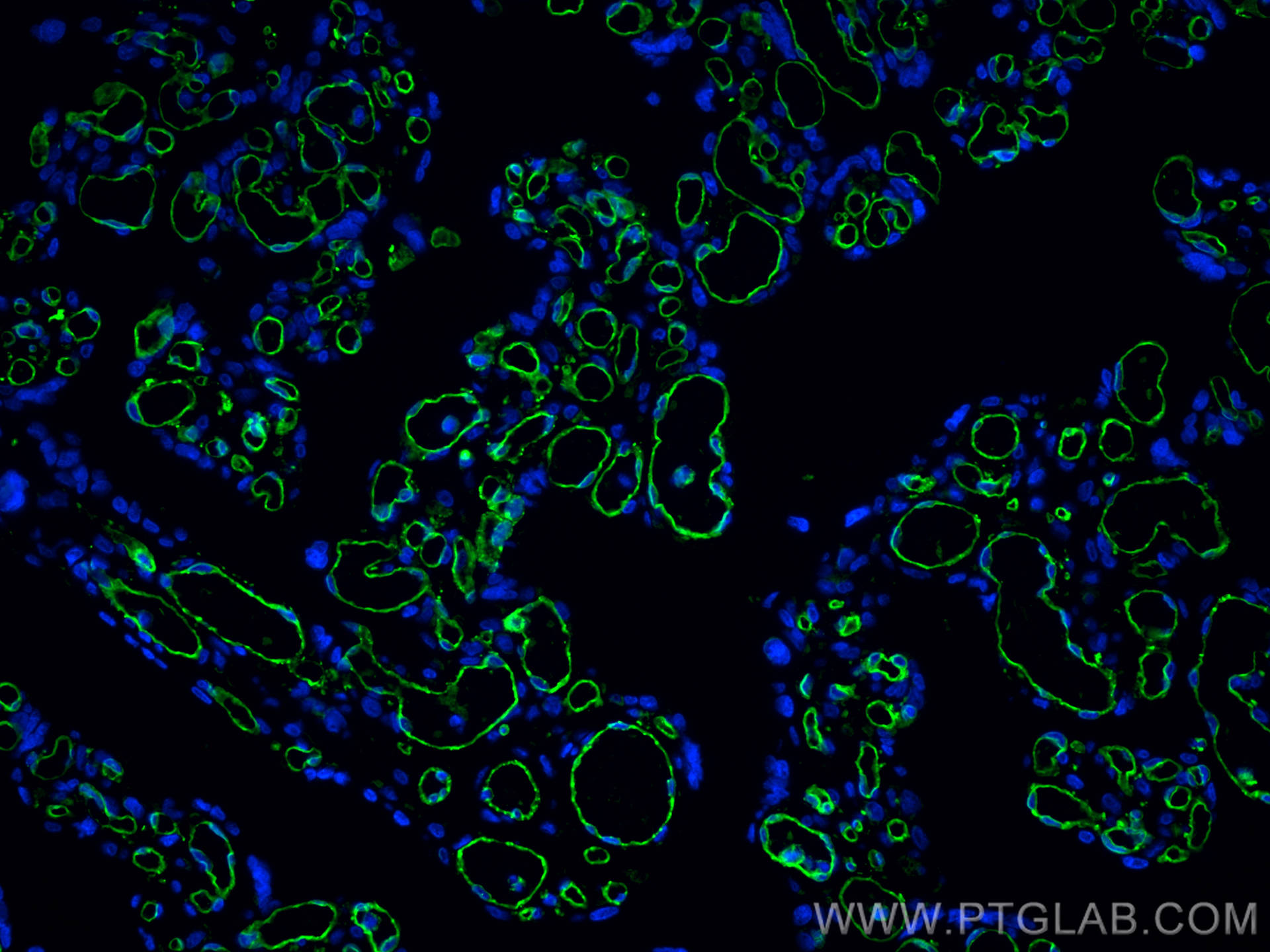 Immunofluorescence (IF) / fluorescent staining of human placenta tissue using CD31 Monoclonal antibody (66065-2-Ig)