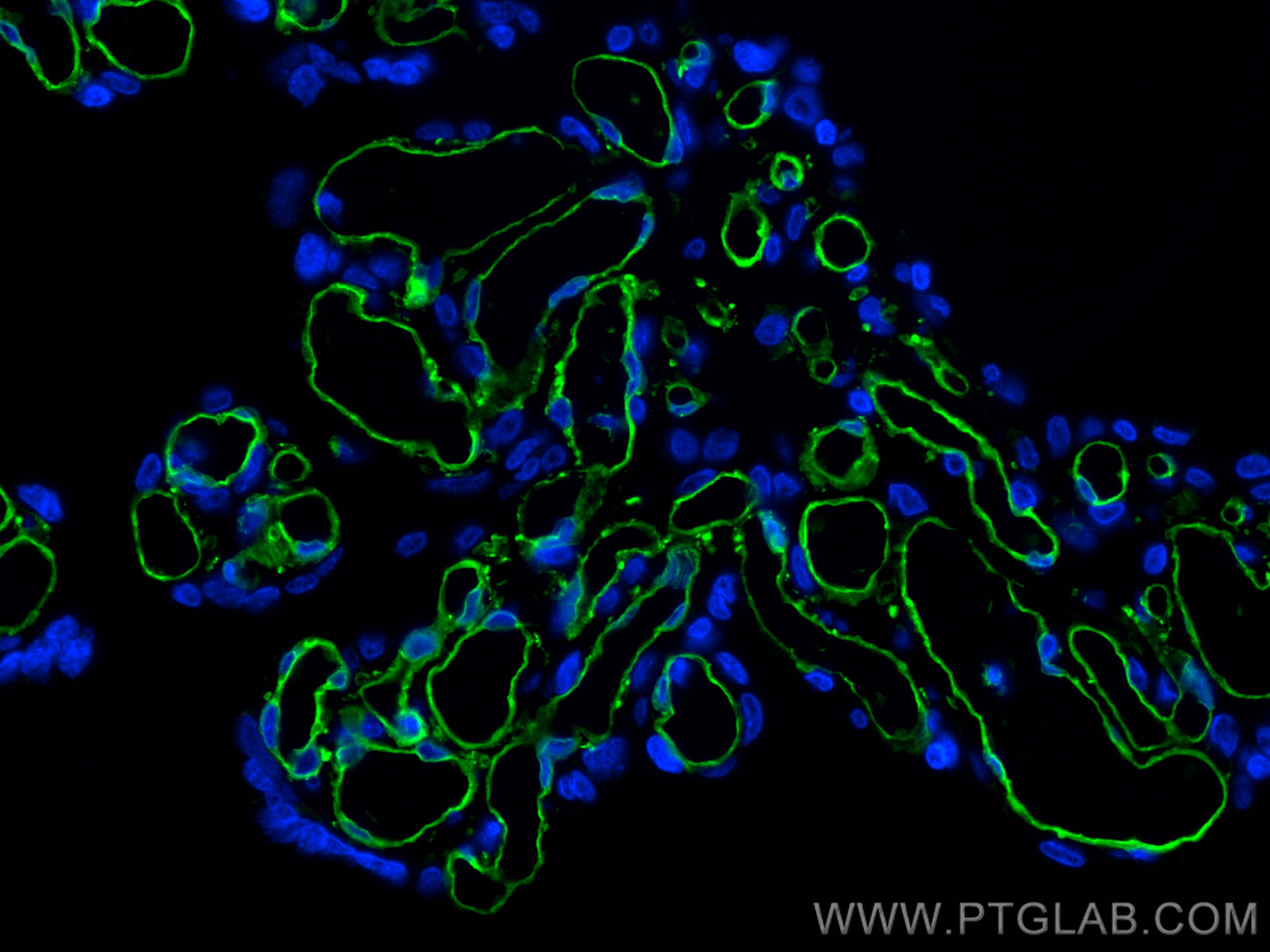 Immunofluorescence (IF) / fluorescent staining of human placenta tissue using CD31 Monoclonal antibody (66065-2-Ig)