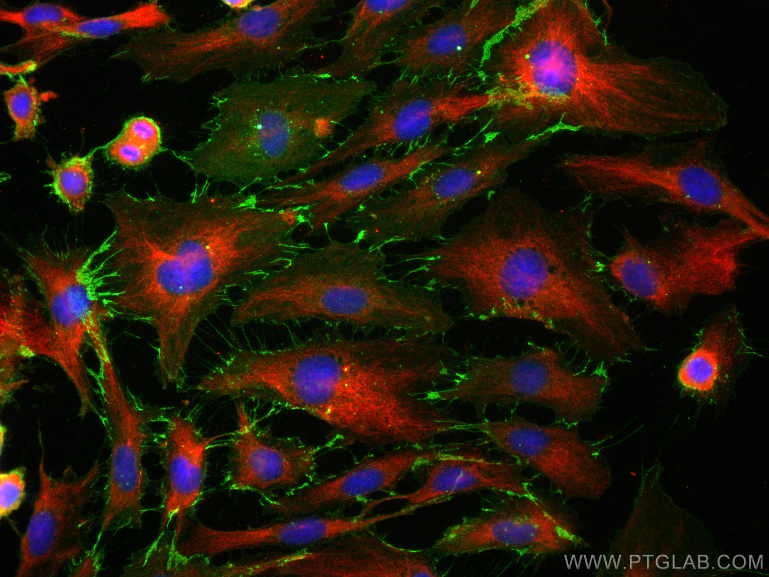 Immunofluorescence (IF) / fluorescent staining of HUVEC cells using CD31 Monoclonal antibody (66065-2-Ig)