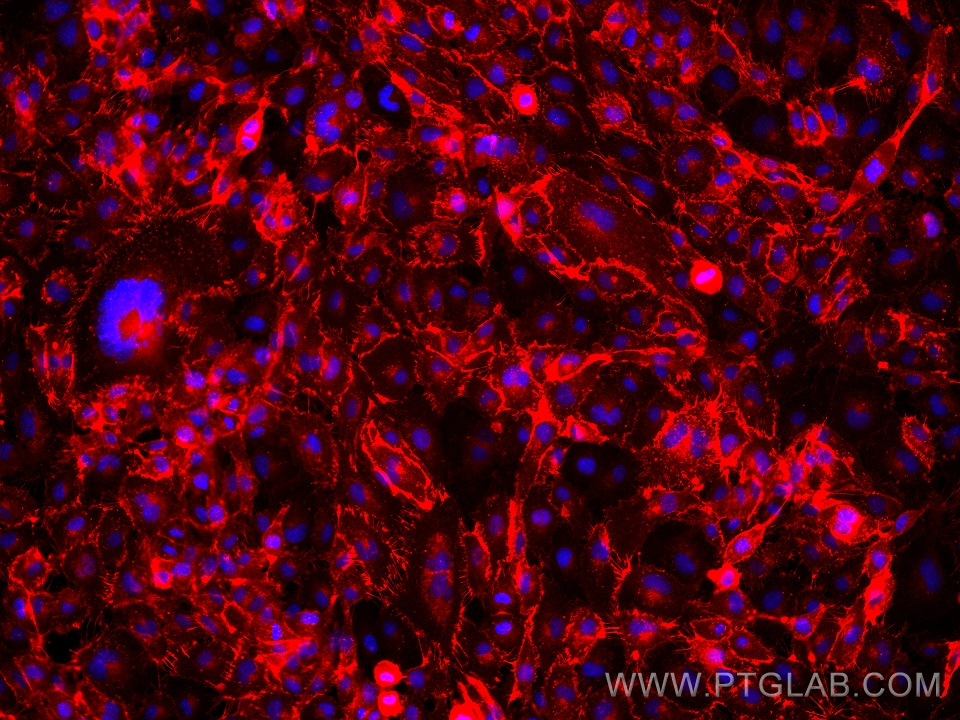 Immunofluorescence (IF) / fluorescent staining of HUVEC cells using CD31 Monoclonal antibody (66065-2-Ig)