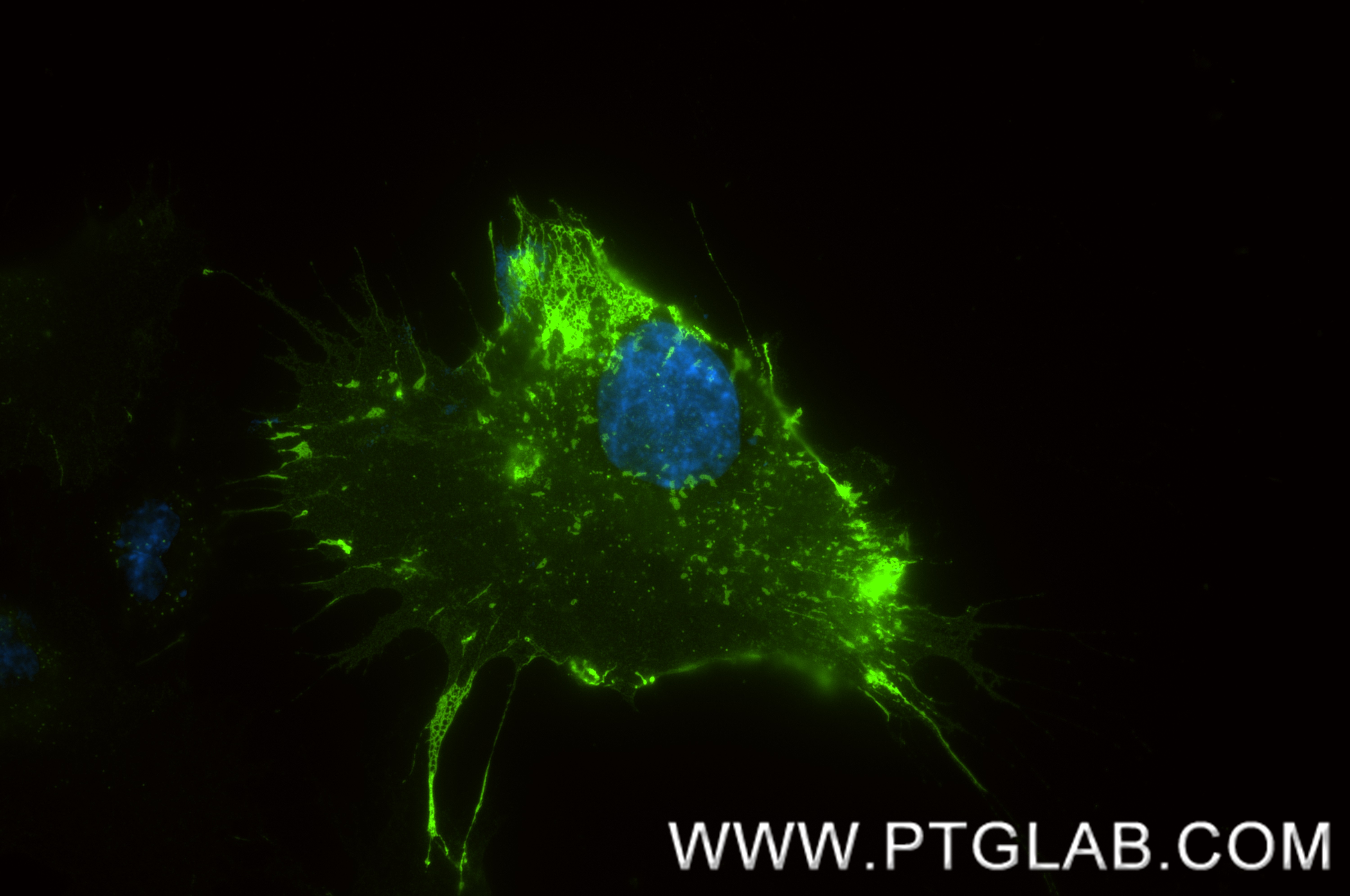 Immunofluorescence (IF) / fluorescent staining of HUVEC cells using CD31 Recombinant antibody (80530-1-RR)