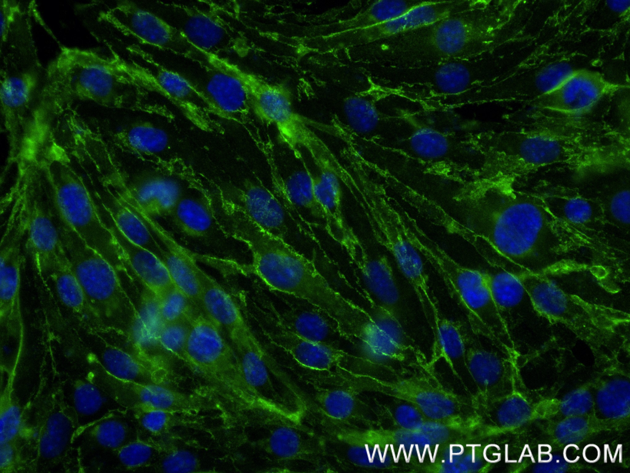 Immunofluorescence (IF) / fluorescent staining of bEnd.3 cells using CD31 Recombinant antibody (84607-4-RR)