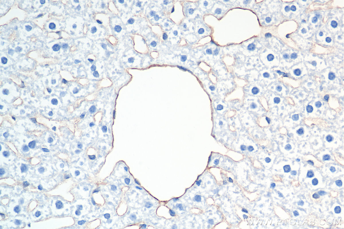 Immunohistochemistry (IHC) staining of mouse liver tissue using CD31 Recombinant antibody (84607-4-RR)