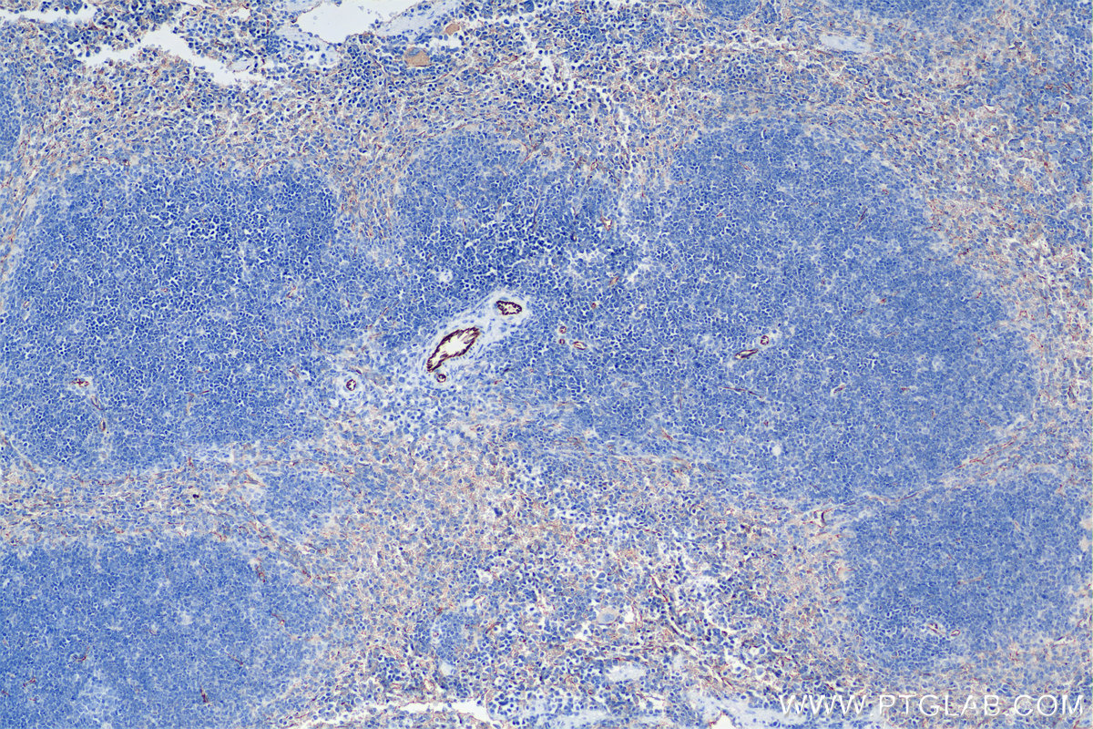Immunohistochemistry (IHC) staining of mouse spleen tissue using CD31 Recombinant antibody (84607-4-RR)