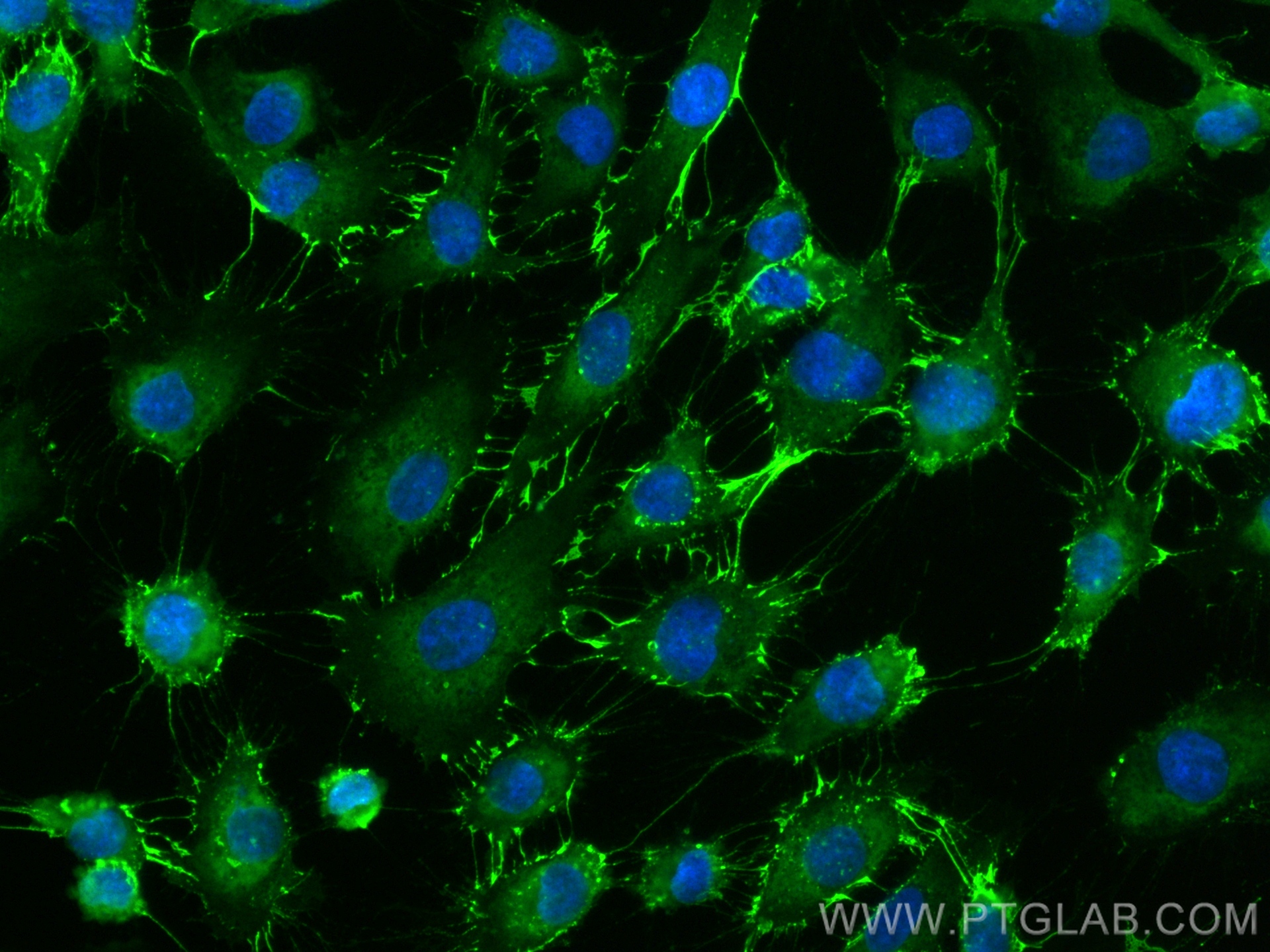 Immunofluorescence (IF) / fluorescent staining of HUVEC cells using CoraLite® Plus 488-conjugated CD31 Polyclonal anti (CL488-11265)