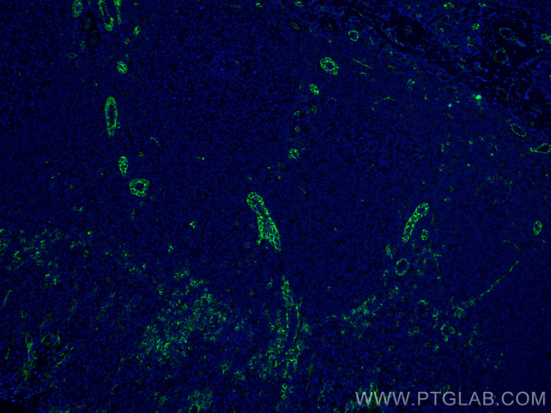 Immunofluorescence (IF) / fluorescent staining of human tonsillitis tissue using CoraLite® Plus 488-conjugated CD31 Monoclonal anti (CL488-66065)