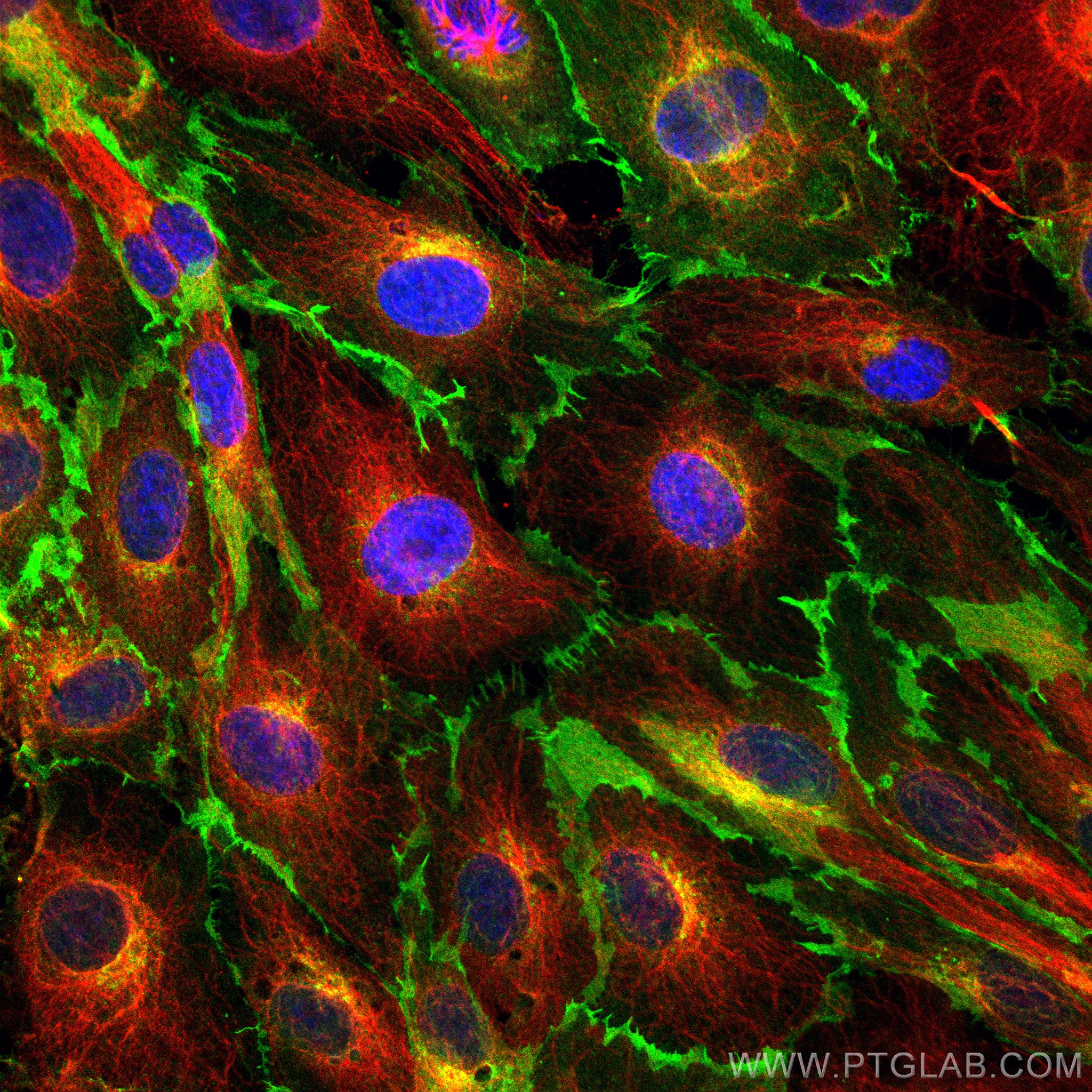 Immunofluorescence (IF) / fluorescent staining of HUVEC cells using CoraLite® Plus 488-conjugated CD31 Monoclonal anti (CL488-66065)