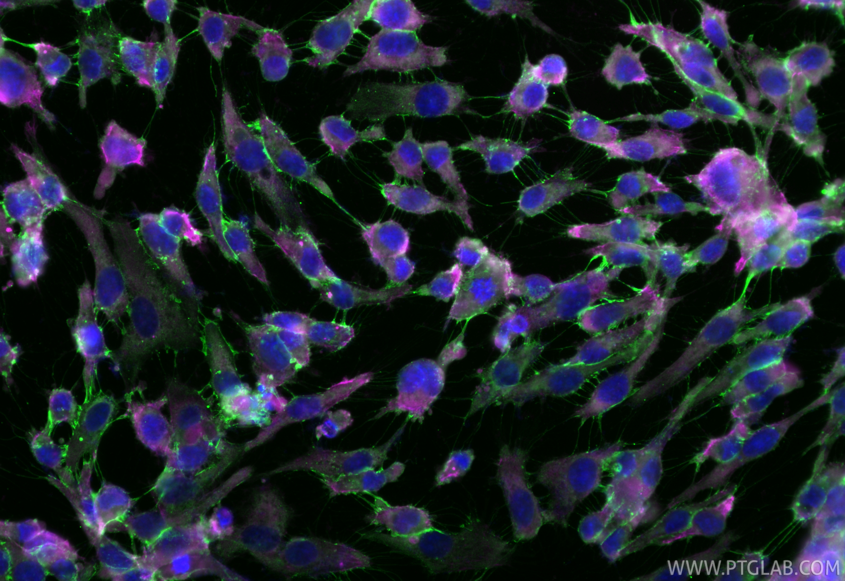 Immunofluorescence (IF) / fluorescent staining of HUVEC cells using CoraLite® Plus 488-conjugated CD31 Monoclonal anti (CL488-66065)