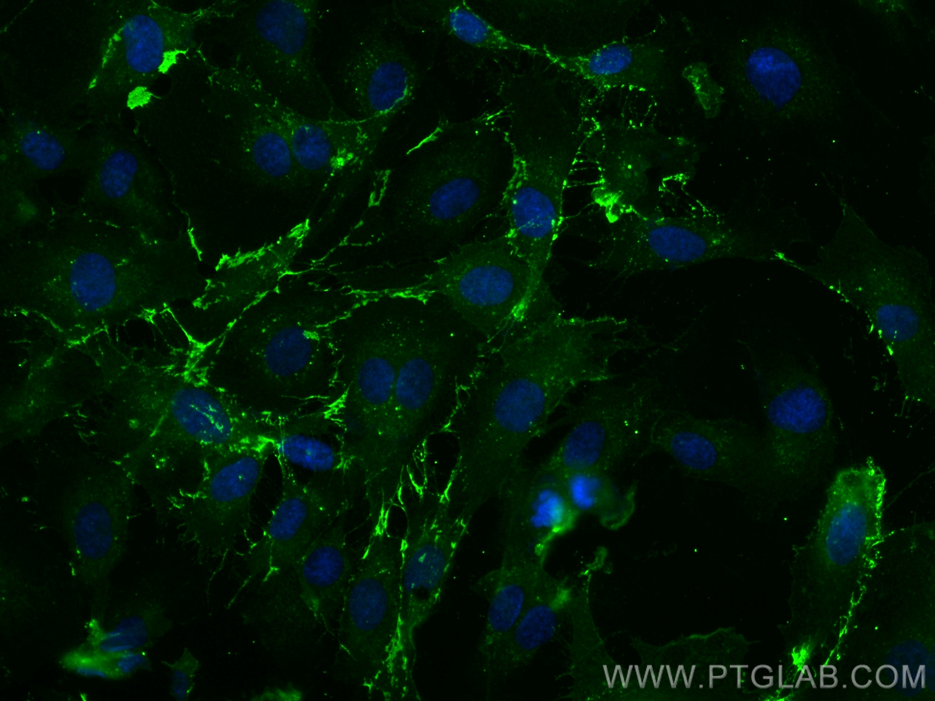 Immunofluorescence (IF) / fluorescent staining of HUVEC cells using CoraLite® Plus 488-conjugated CD31 Recombinant ant (CL488-80530)