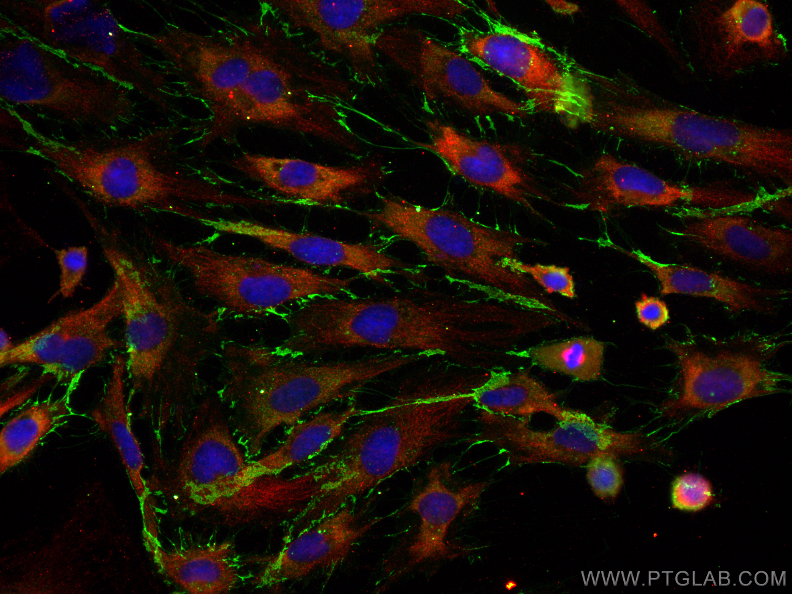 Immunofluorescence (IF) / fluorescent staining of HUVEC cells using CoraLite® Plus 488-conjugated CD31 Recombinant ant (CL488-80530)