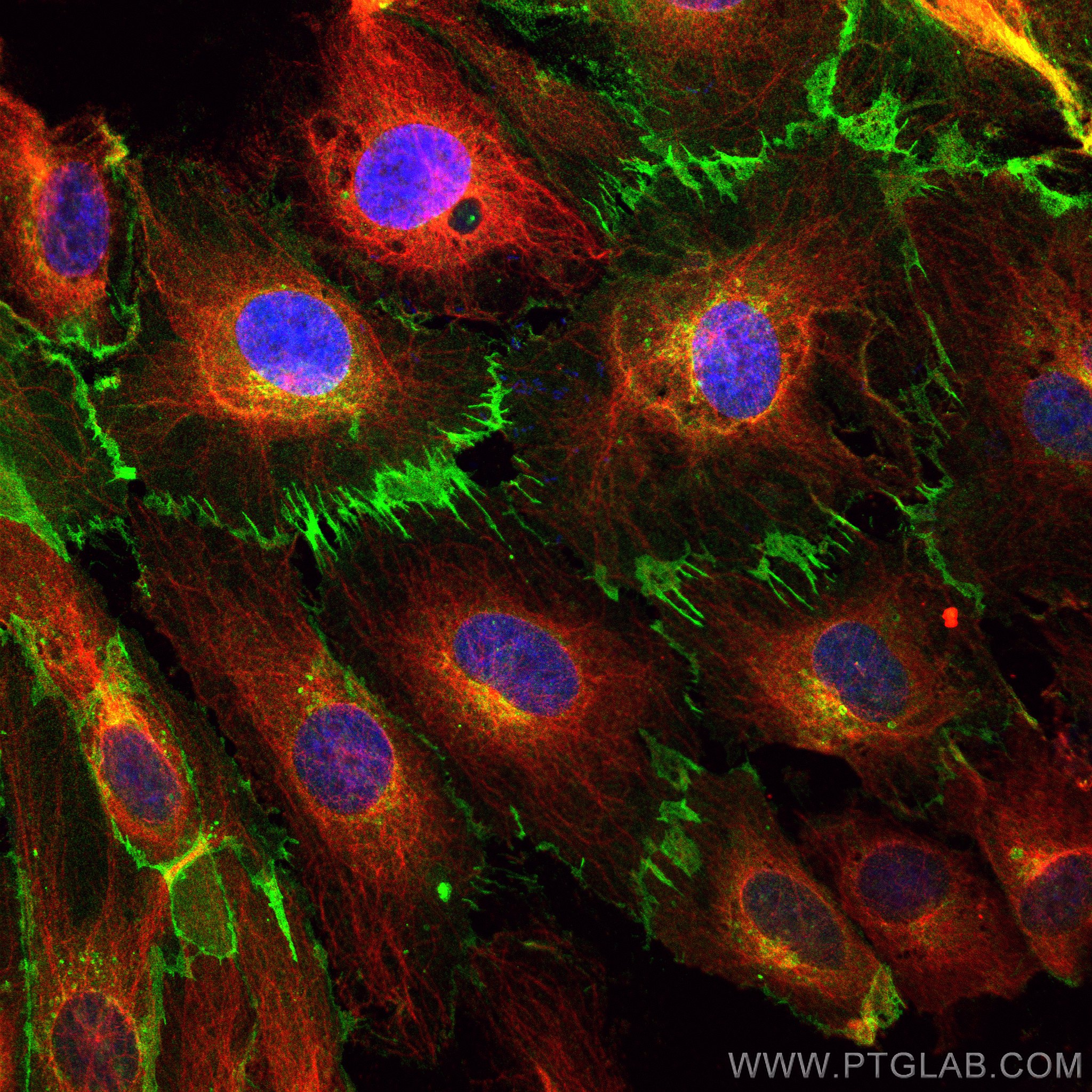 Immunofluorescence (IF) / fluorescent staining of HUVEC cells using CoraLite® Plus 488-conjugated CD31 Recombinant ant (CL488-80530)