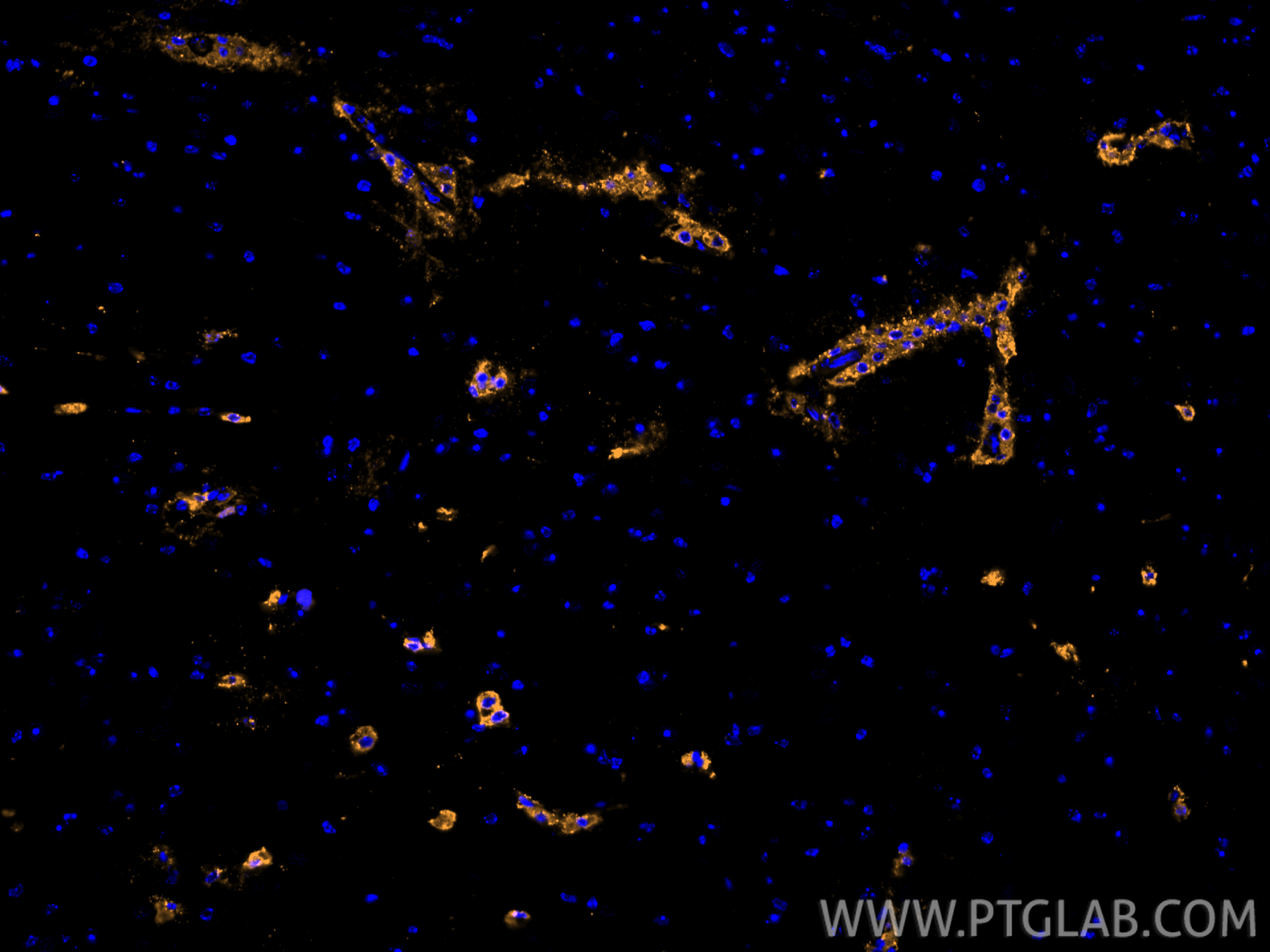 Immunofluorescence (IF) / fluorescent staining of mouse brain tissue using CoraLite® Plus 555-conjugated CD31 Polyclonal anti (CL555-28083)