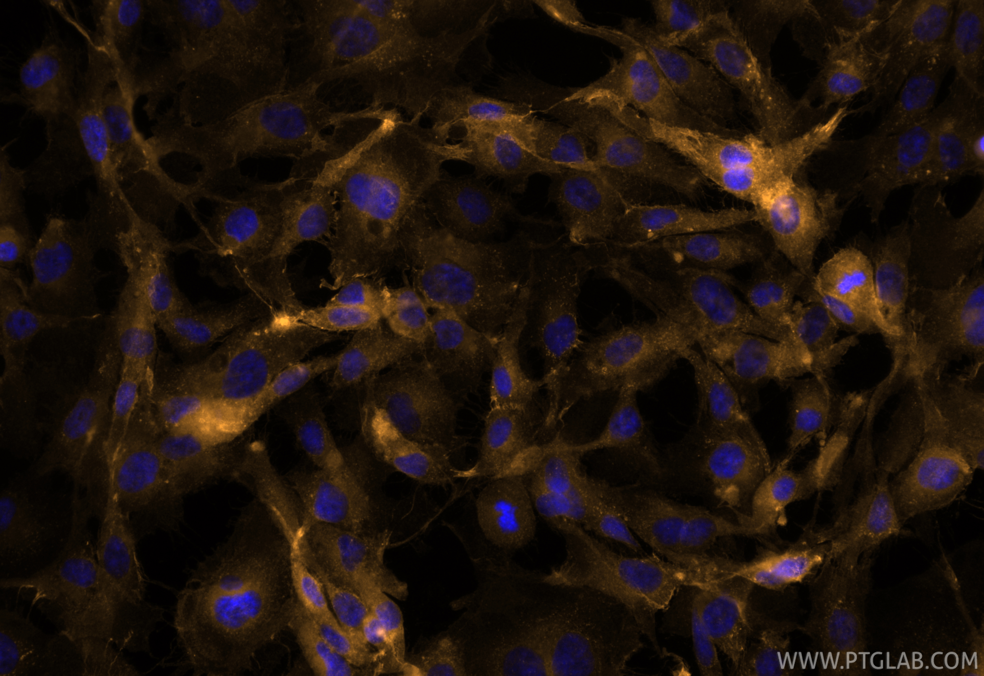 Immunofluorescence (IF) / fluorescent staining of HUVEC cells using CoraLite® Plus 555-conjugated CD31 Recombinant mon (CL555-80530)