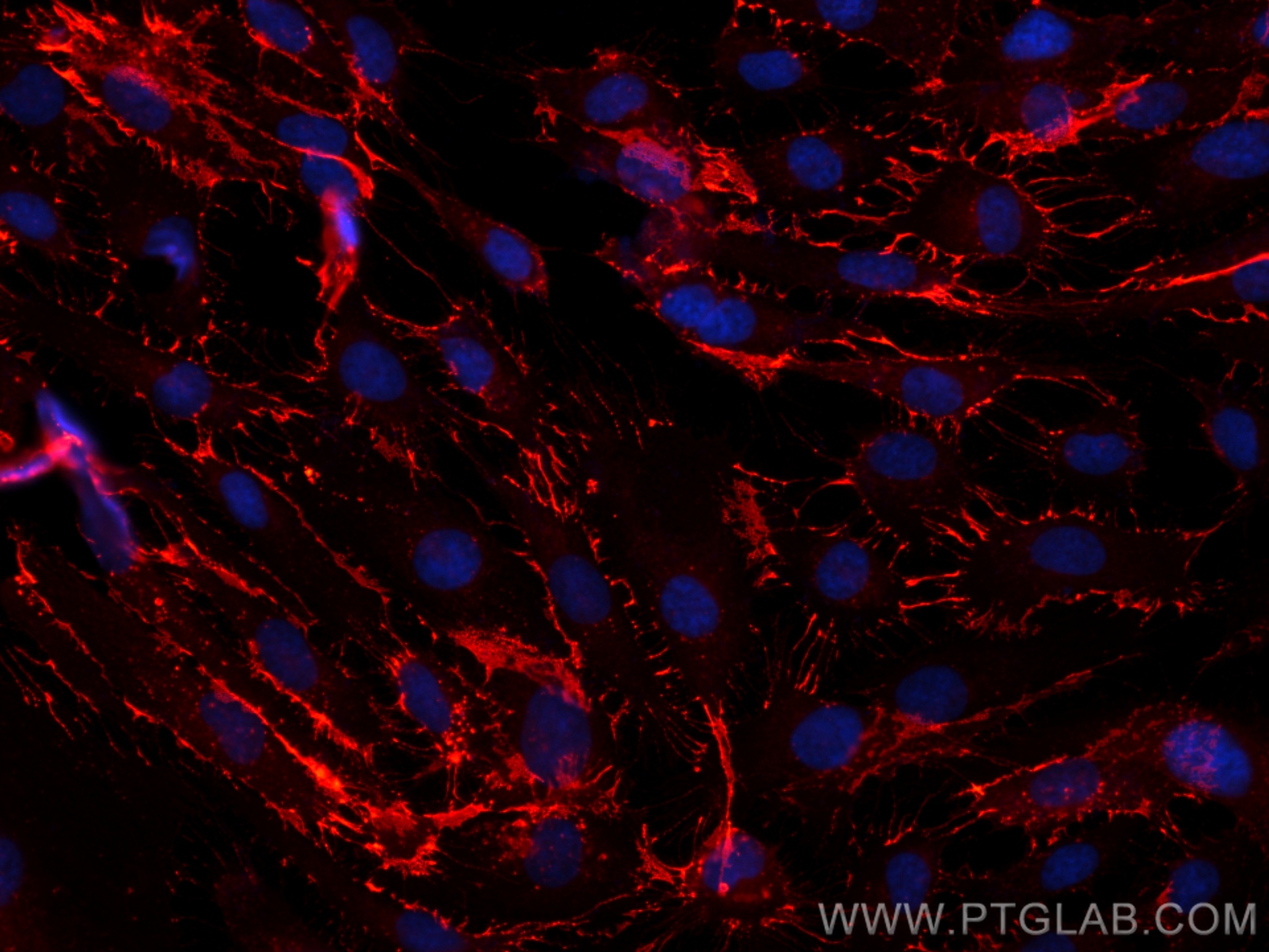 Immunofluorescence (IF) / fluorescent staining of HUVEC cells using CoraLite®594-conjugated CD31 Recombinant antibody (CL594-80530)