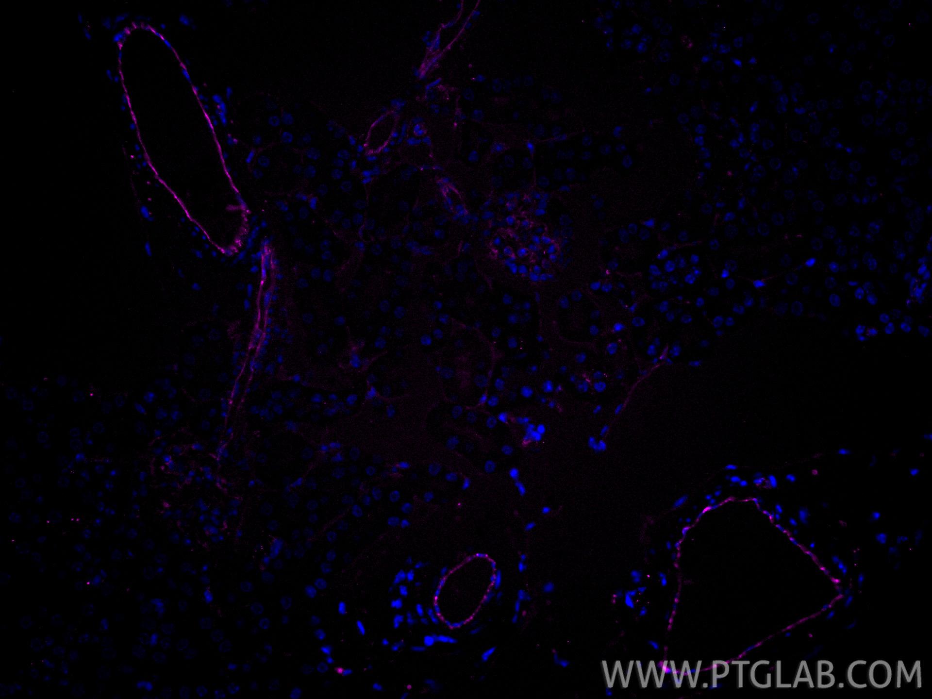 Immunofluorescence (IF) / fluorescent staining of mouse kidney tissue using CoraLite® Plus 647-conjugated CD31 Polyclonal anti (CL647-28083)