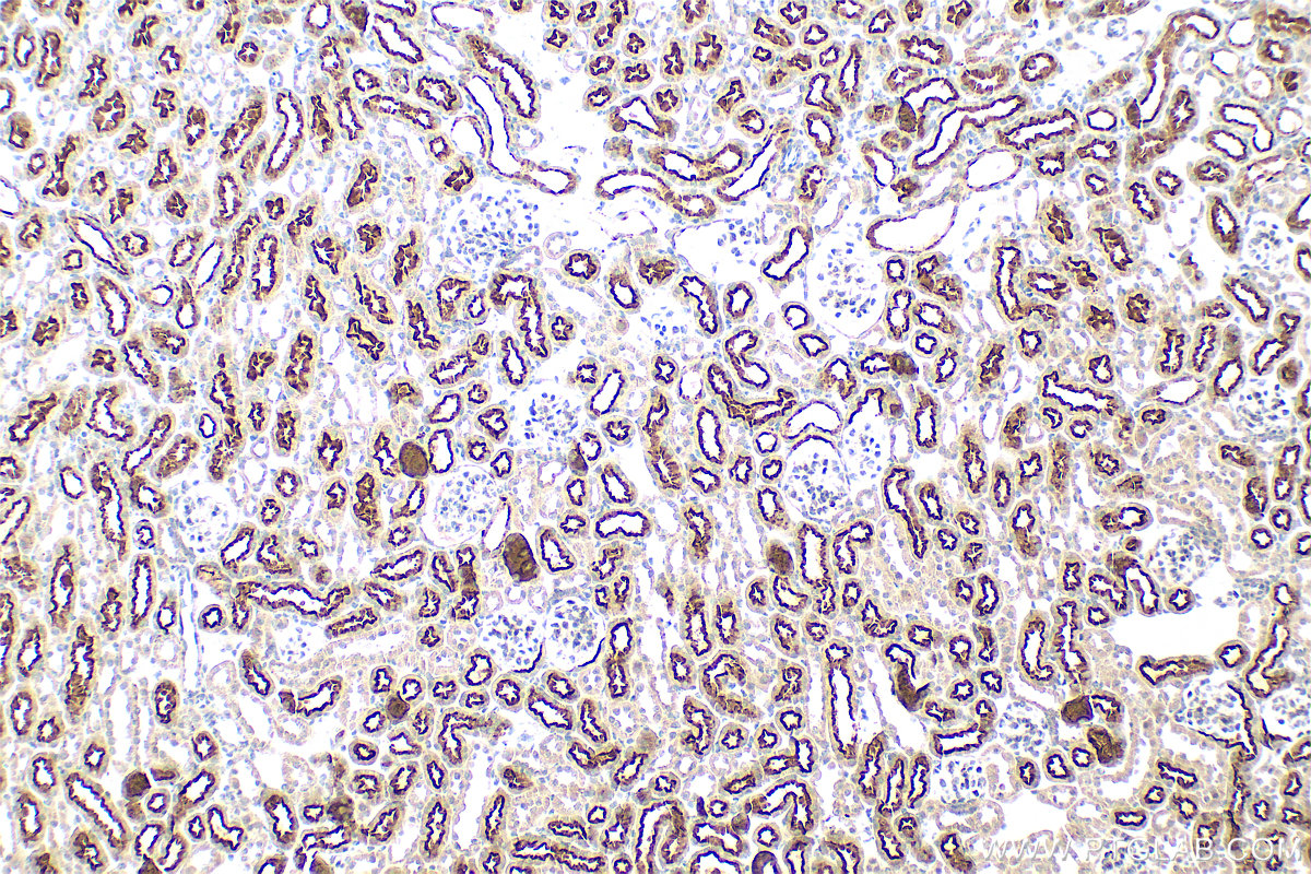 Immunohistochemistry (IHC) staining of mouse kidney tissue using CD320 Polyclonal antibody (10343-1-AP)